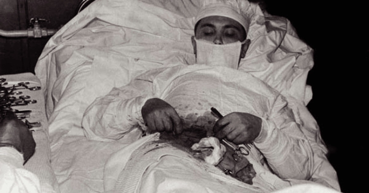 Povestea doctorului Leonid Rogozov, chirurgul rus care s-a operat singur de apendicită / FOTO