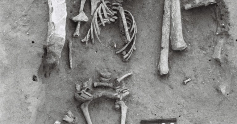 A fost descoperit cel mai vechi caz de Sindromul Down