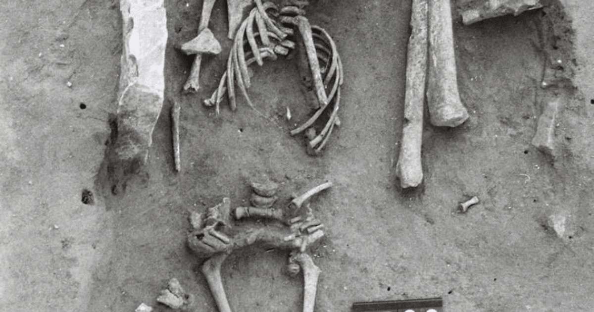 A fost descoperit cel mai vechi caz de Sindromul Down