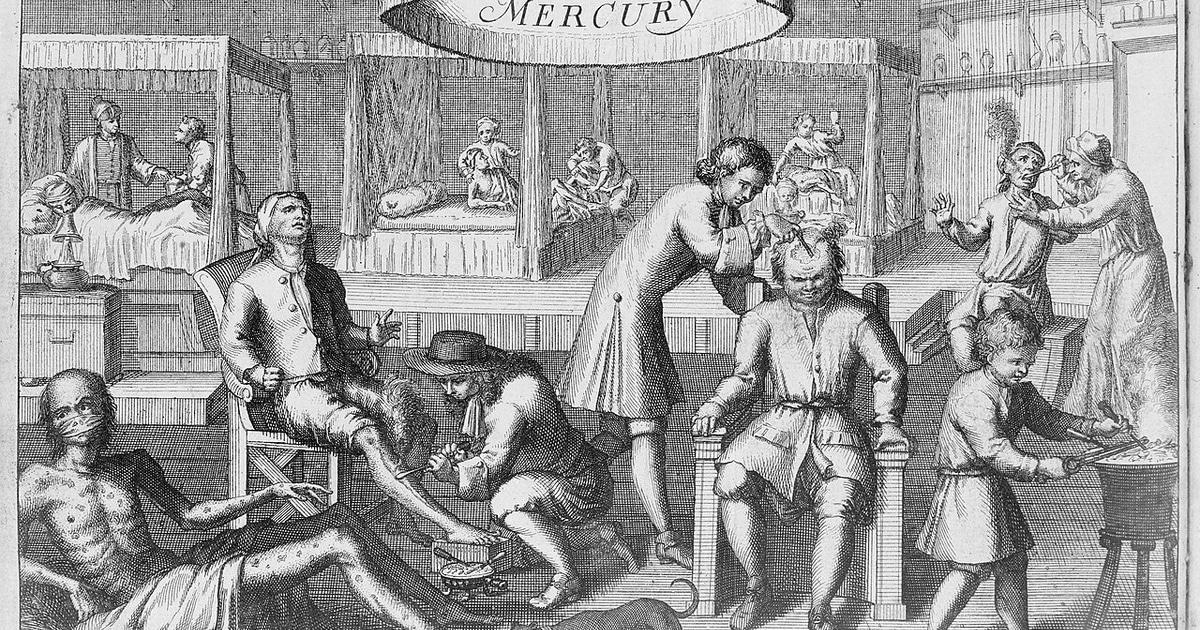 Cea mai veche dovadă a existenței sifilisului, descoperită la un schelet vechi de 5.500 de ani