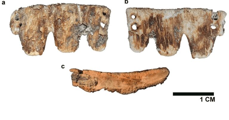O punte dentară rară din os, din secolul al XIX-lea, descoperită în Portugalia